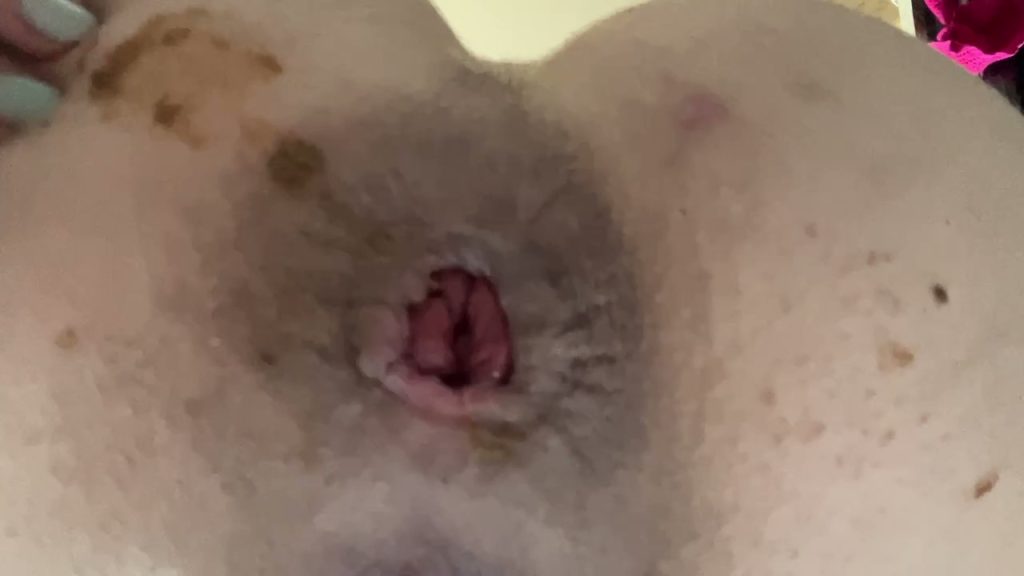 Pooping on Your Face